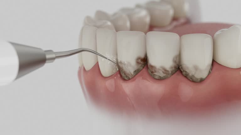 Trusted Invisalign Clear Aligners service in Paintsville, KY - Dentist Open Now